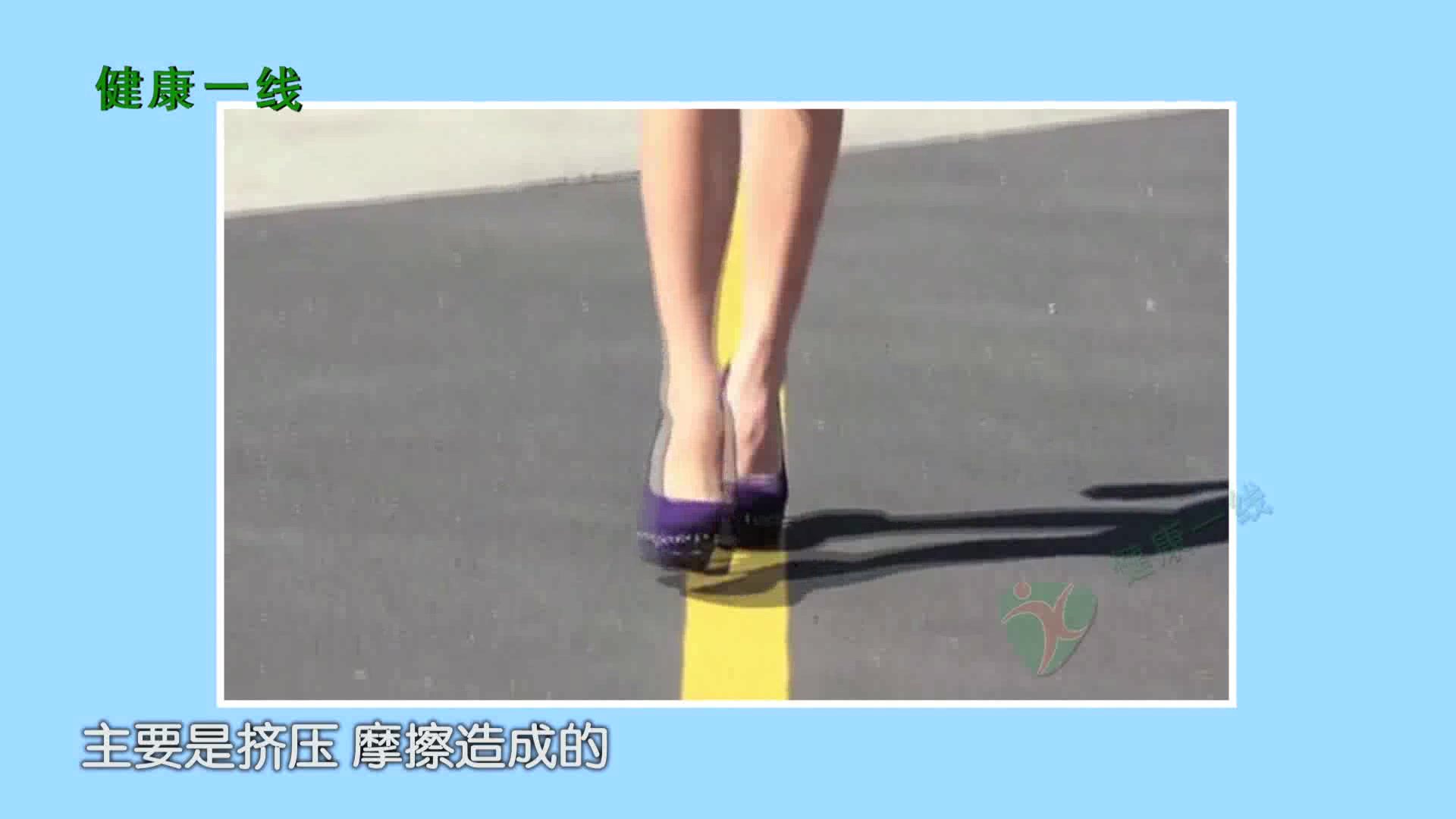 鸡眼是怎么形成的?看完你还敢穿高跟鞋吗?
