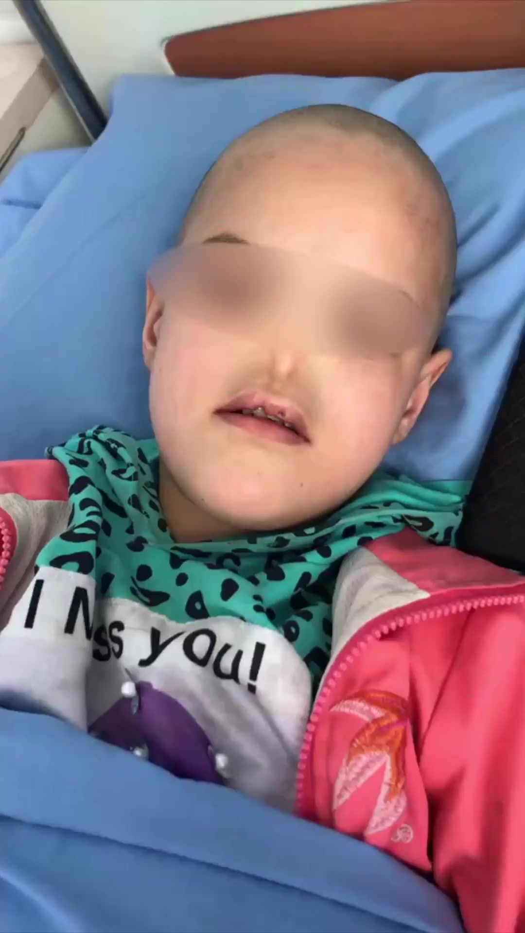 9岁女孩先天性无鼻:只能靠口呼吸,手术获得鼻子